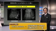 Dr.小川のアグレッシブ腹部エコー　肝臓編 | 第3回　びまん性肝疾患2－エコーパターンと肝内脈管評価を中心に－