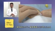 Dr.志賀のパーフェクト！基本手技 | 第8回　動脈内留置カテーテル挿入