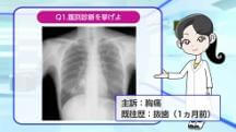 Dr.長尾の胸部X線クイズ　上級編 | 第1回　画像だけでは気付けない
