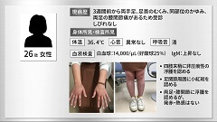 一発診断 | 第12回　両手足のむくみ・かゆみと膝関節痛の26歳女性