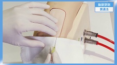 研修医のための救急科ベーシック2 | 第4回　手技(救急)　動脈穿刺