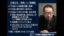 Dr.岩田のFUO不明熱大捜査線 | 第2回 外来 case2 ―72歳男性・・CRPが下がらない―