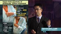 CliPS － Clinical Presentation Stadium － ＠TOKYO2013 | 脳卒中後の固定した麻痺　―数年経過しても治療により改善するのか？―　【篠田雄一】