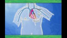 出直し看護塾－心電図と不整脈の基礎－ | 第3回 弱点克服！心室性心電図の急所