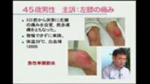Dr.須藤のビジュアル診断学 | 第6回 四肢・関節シリーズ