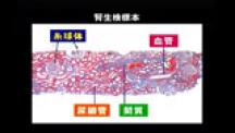 Dr.安田のクリアカット腎臓学 | 第4回　腎生検から捉える(1)