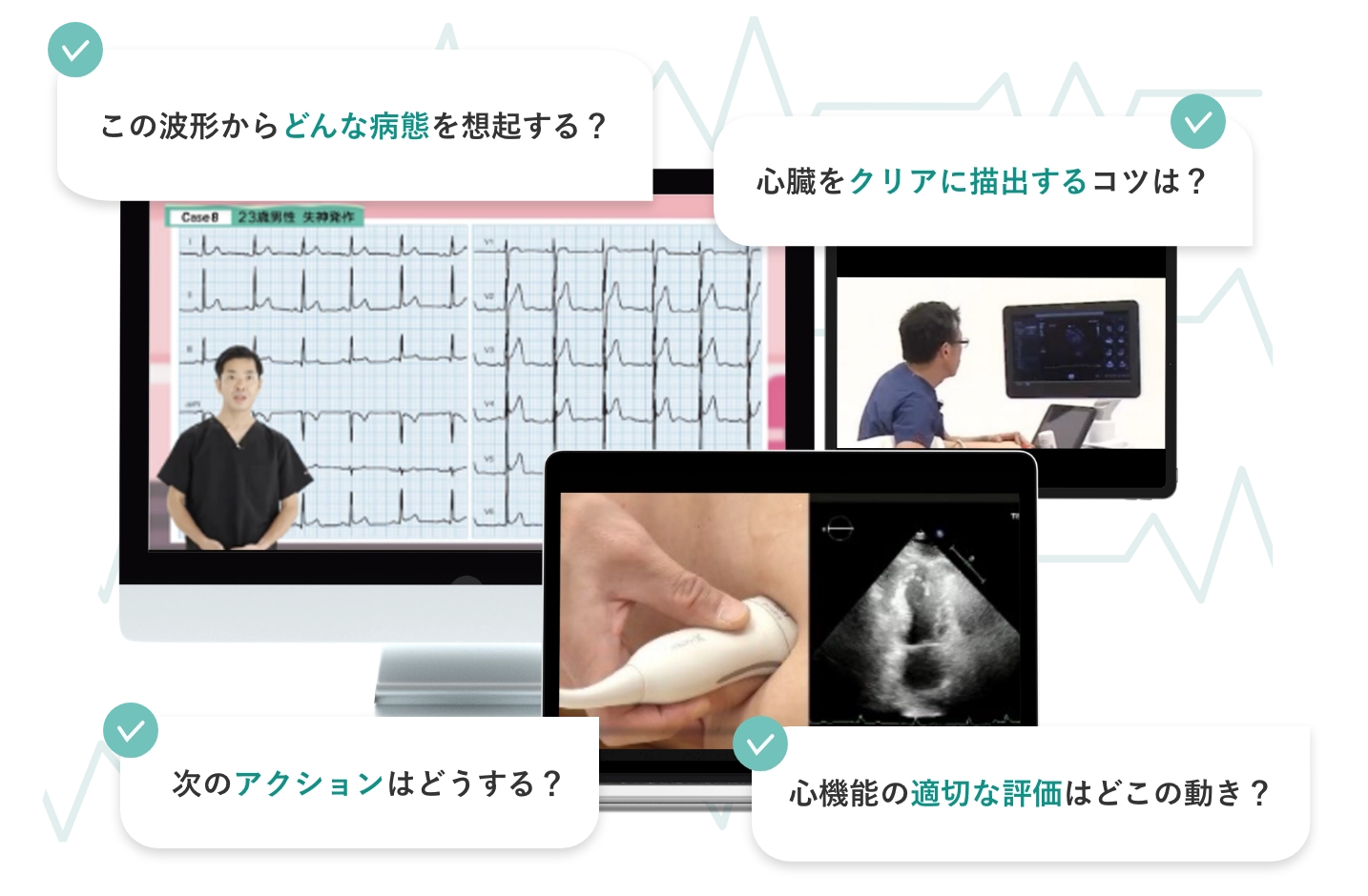 心電図の結果の解釈
