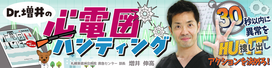 Dr.増井の心電図ハンティング