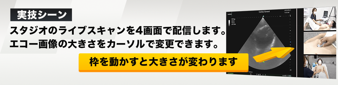 POCUSセミナーの実技シーン
