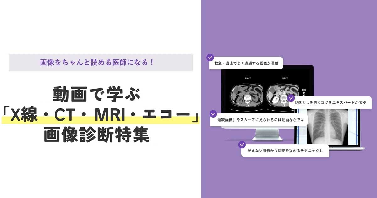動画で学ぶX線・CT・MRI・エコー画像診断特集｜CareNeTV