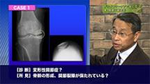 骨太！Dr.仲田のダイナミック整形外科２ | 第4回　プライマリ・ケアで役に立つ骨、関節X線読影