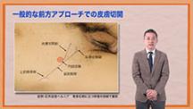 Dr.みやざきの鼠径ヘルニア手術テクニックコレクション /ケアネットDVD [DVD-ROM] 宮崎　恭介