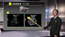 Dr.小川のアグレッシブ腹部エコー　肝臓編 | 第1回　基本を押さえて異常を知る！超音波解剖と走査のポイント