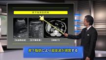 Dr.小川のアグレッシブ腹部エコー　肝臓編 | 第2回　びまん性肝疾患1－脂肪肝を中心に－