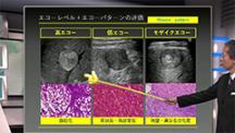 Dr.小川のアグレッシブ腹部エコー　肝臓編 | 第5回　肝腫瘤性病変と肝細胞がん2 －バリエーションを学ぶ－
