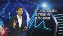 Dr.香坂のすぐ行動できる心電図　ECG for the Action! | 第5回　心電図の本丸　STの上昇