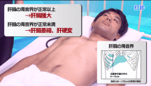 Dr.徳田のすぐできるフィジカル超実技 | 第6回　腹部のフィジカル