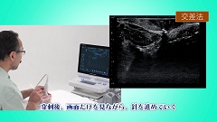 Dr.白石のLet's エコー 運動器編｜CareNeTV
