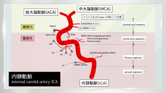 脳血管内治療STANDARD | 第3回　治療に必要な血管解剖