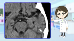 Dr.金井のCTクイズ　初級編 | 第2回　頭部CTの評価が次のアクションを左右する