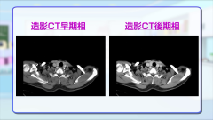 Dr.金井のCTクイズ　初級編 | 第6回　造影CTで病態分類までしてコンサルト