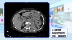 Dr.金井のCTクイズ　初級編 | 第7回　CT画像から患部のサイズを正しく計測