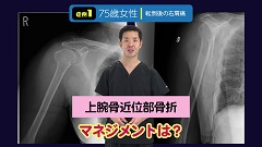 Dr.増井の骨折ハンティング | 第7回　肩関節痛