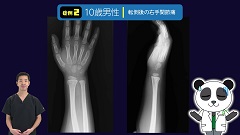 Dr.増井の骨折ハンティング | 第10回　手関節痛