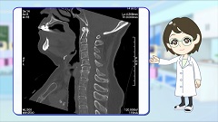 Dr.金井のCTクイズ　中級編 | 第2回　頸部：CTで一発診断！不要な検査・治療を回避