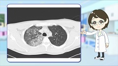 Dr.金井のCTクイズ　中級編 | 第3回　胸部：珍しい病態から画像パターンを考える