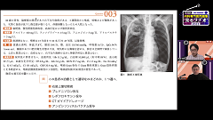 THE内科専門医問題集“見るラヂオ”2023 | 第6回　呼吸器