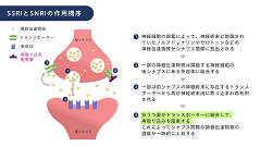 非精神科医のための向精神薬の使い方 | 第2回　抗うつ薬の使い方