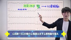 Dr.翼の心電図検定3級合格ポイント塾 | 第3回　心房細動と心房粗動