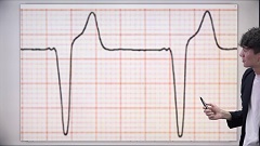 Dr.翼の心電図検定3級合格ポイント塾 | 第7回　WPW症候群