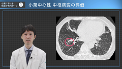 呼吸器内科医Kのイメージと病態がつながる胸部CTの読み方 | 第1回　肺野条件