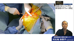 整形外科SURGICAL TECHNIQUE動画シリーズ 　骨折のピンニングと経皮的スクリュー固定　～経皮テクニックを極める～ | 第3回　骨折手術における術中K-wireの有効な使用法