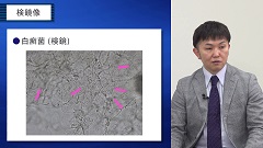 プライマリ・ケアの疑問　Dr.前野のスペシャリストにQ 皮膚科編 | 第9回　足白癬を知る