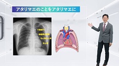 Dr.香坂の循環器診療フロントライン | 第9回　その他の話題