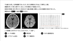 総合内科専門医試験　バーチャル模試2024 | 第5回　第81～100問