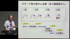 （JPEC研修） 病態と薬理を理解して薬学的ケアを実践する－肺がん－ | 第1回　肺癌の診断と治療について