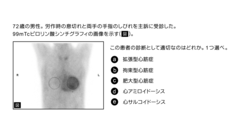 内科専門医試験　バーチャル模試2025 | 第2回　第21～40問