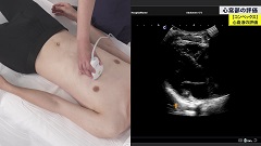 Dr.瀬良の救急エコーEFASTインストラクション | 第4回　心窩部評価