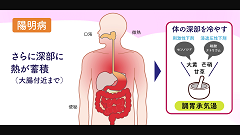 Dr.伊東のストーリーで語る漢方薬 | 第7回 六病位:乾姜と附子 Dr.伊東のストーリーで語る漢方薬 | 第7回 六病位:乾姜と附子