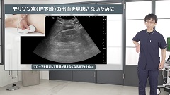 Dr.瀬良の救急エコーEFASTインストラクション | 第5回　右側胸腹部評価