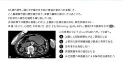 総合内科専門医試験　バーチャル模試2025 | 第3回　第41～60問