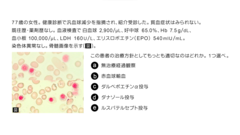 総合内科専門医試験　バーチャル模試2025 | 第4回　第61～80問