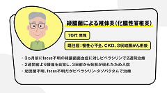 高齢者感染症ベストアンサー | 第2回　高齢者感染症診療の誤解