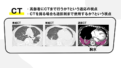 高齢者感染症ベストアンサー | 第3回　検査適応と解釈