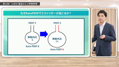 Dr.Junの人工呼吸管理スピードマスター | 第12回　COPD・喘息の人工呼吸管理