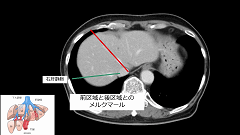 研修医のための画像診断 | 第3回　腹部画像　基礎編